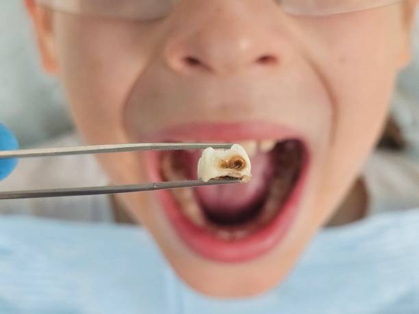 Best Weekend Emergency Dentist in Toledo, IL
