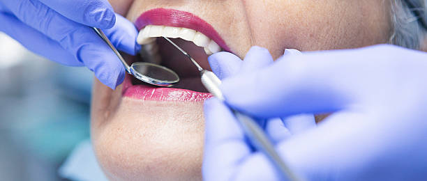 Best Emergency Denture Repair in Toledo, IL